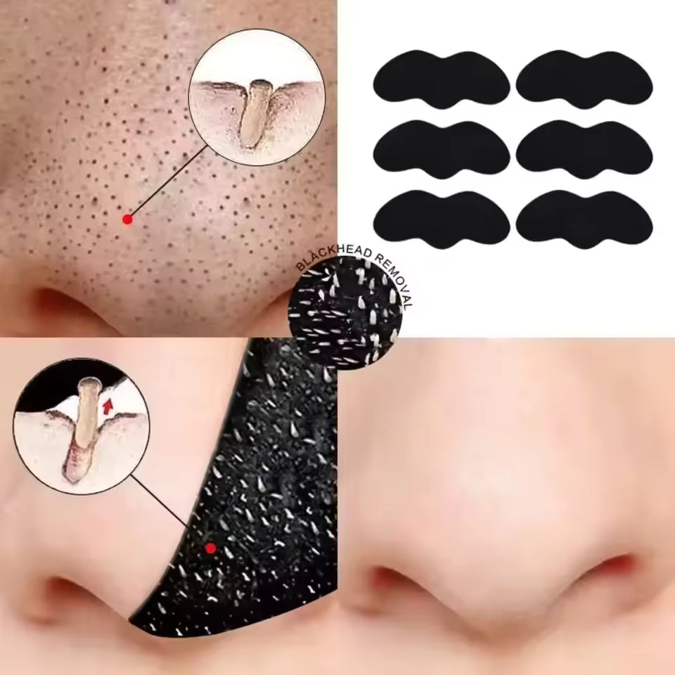 Black Head Remover Mask