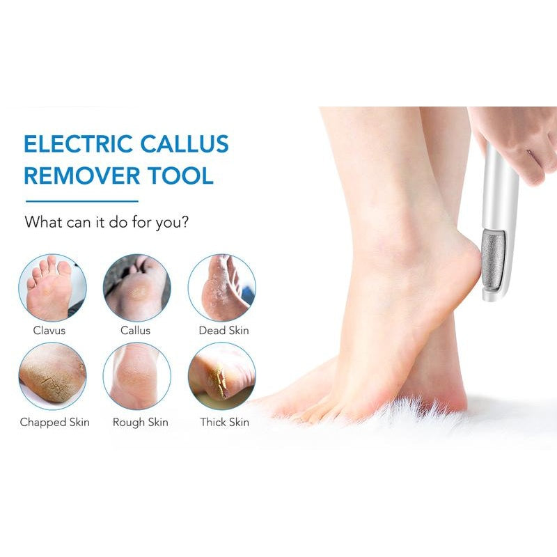 Electric Foot Callus Remover VIP